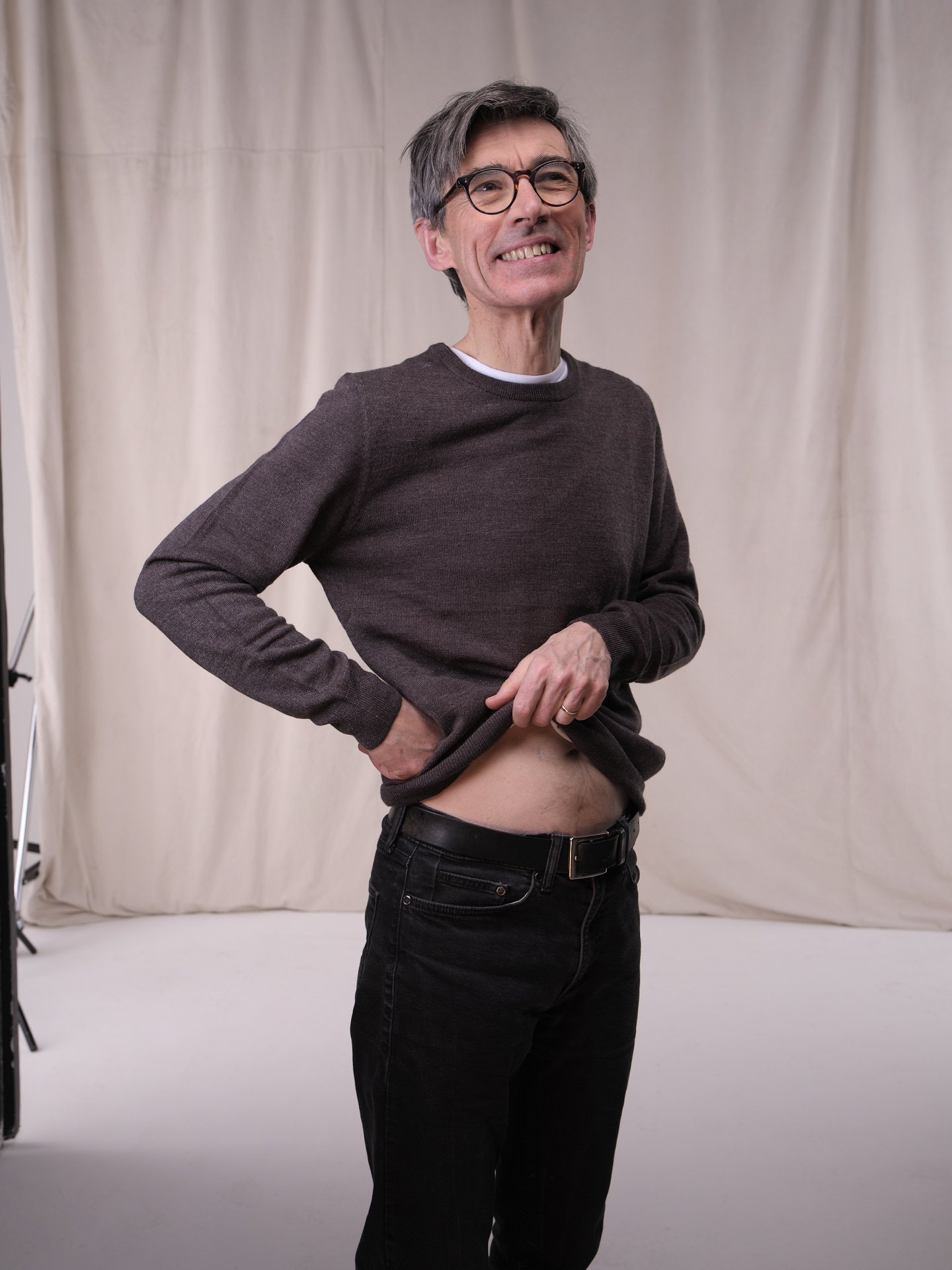 Living kidney donor John lifting his top