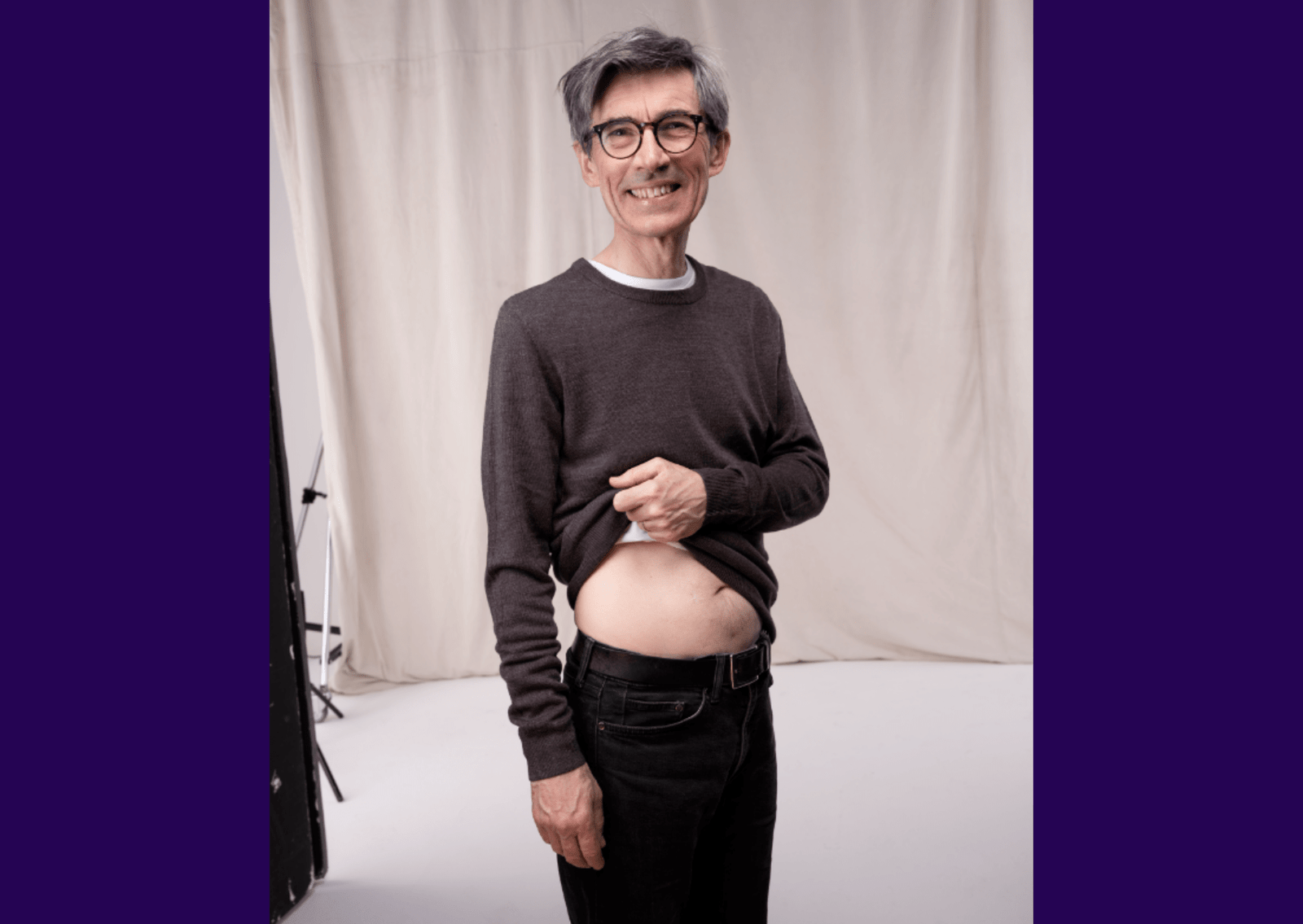 Image of living kidney donor John lifting his top.
